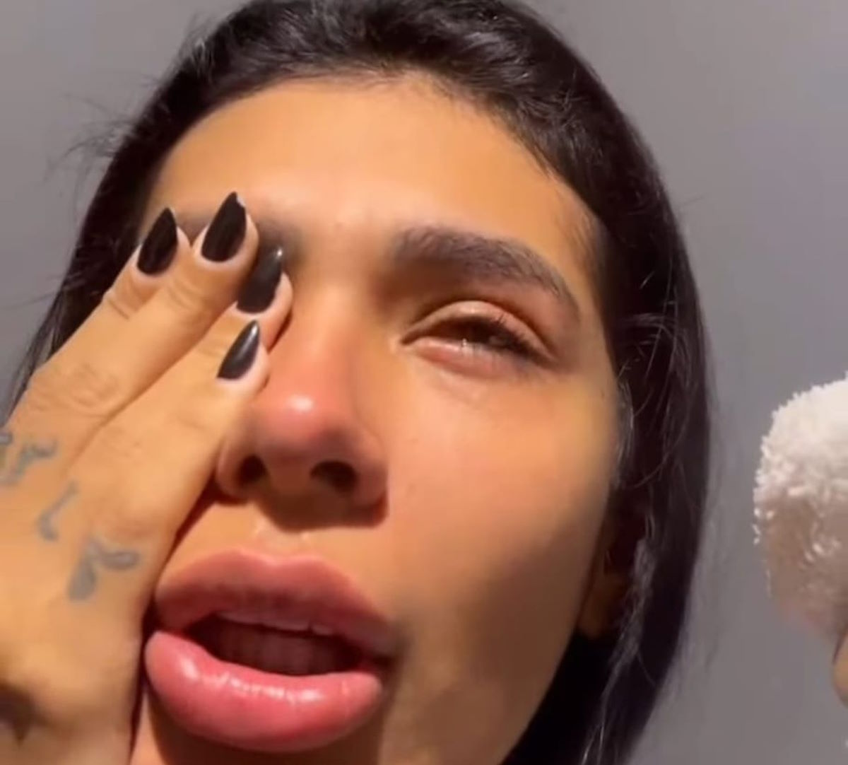 Pocah cancela show após acertar o olho com elástico de ferro: “Tá doendo muito”
